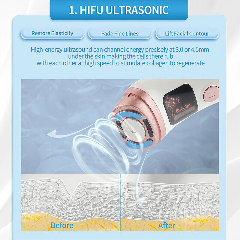 ultrasound hifu